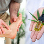 How to Use CBD Oil for Neuropathy